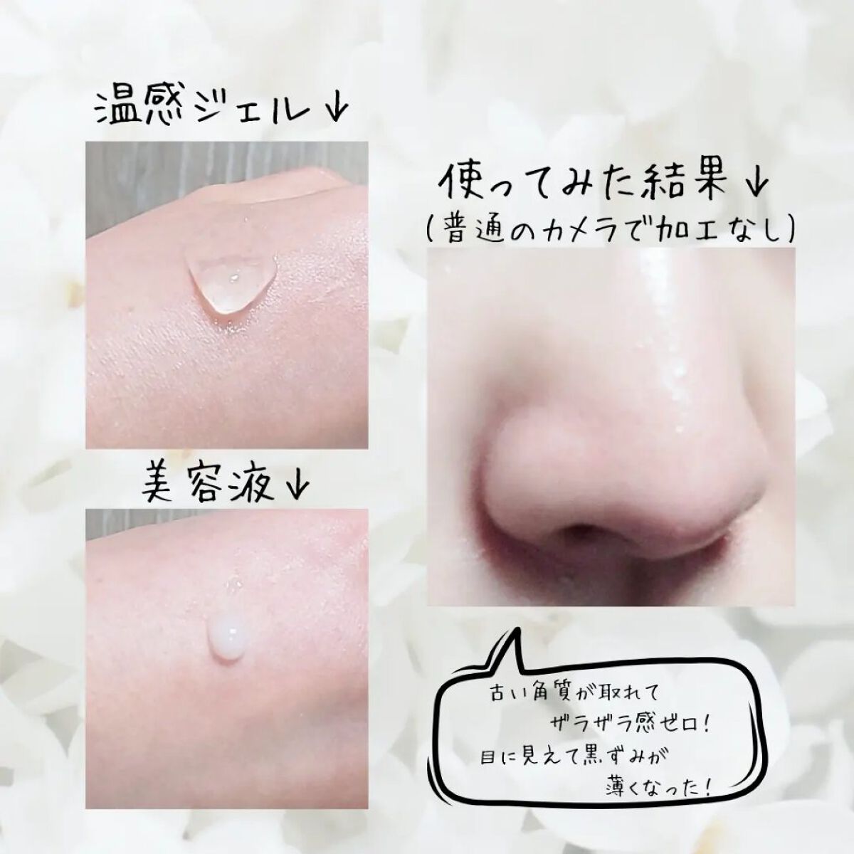 チョコブラ スペシャル毛穴ケアセット/Chocobra/スキンケアキットを使ったクチコミ（2枚目）