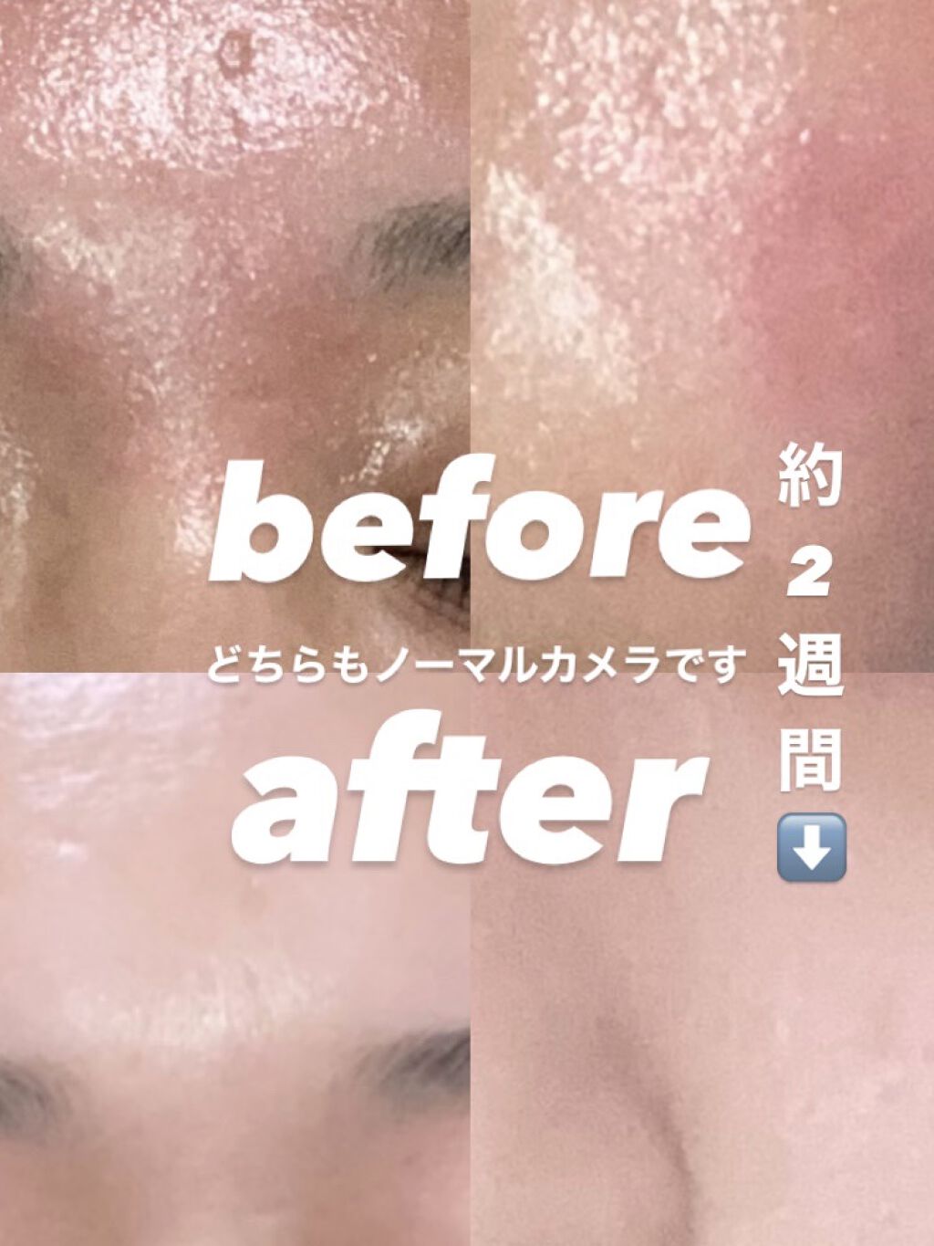 ロゼット洗顔パスタ アクネクリア/ロゼット/洗顔フォームを使ったクチコミ（1枚目）