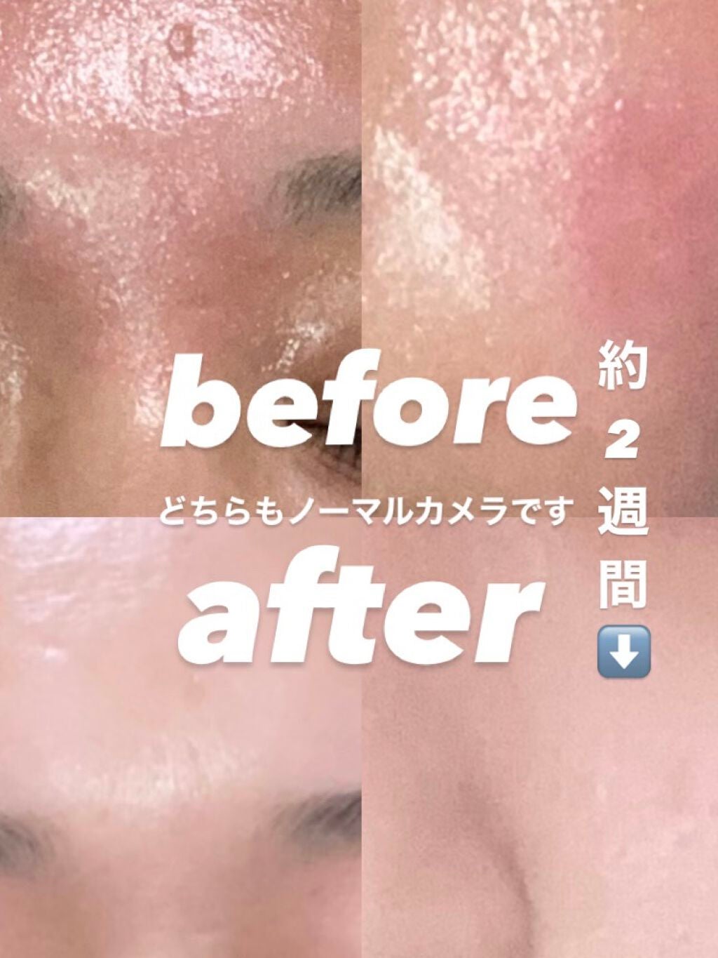 ロゼット洗顔パスタ アクネクリア/ロゼット/洗顔フォームを使ったクチコミ(1枚目)