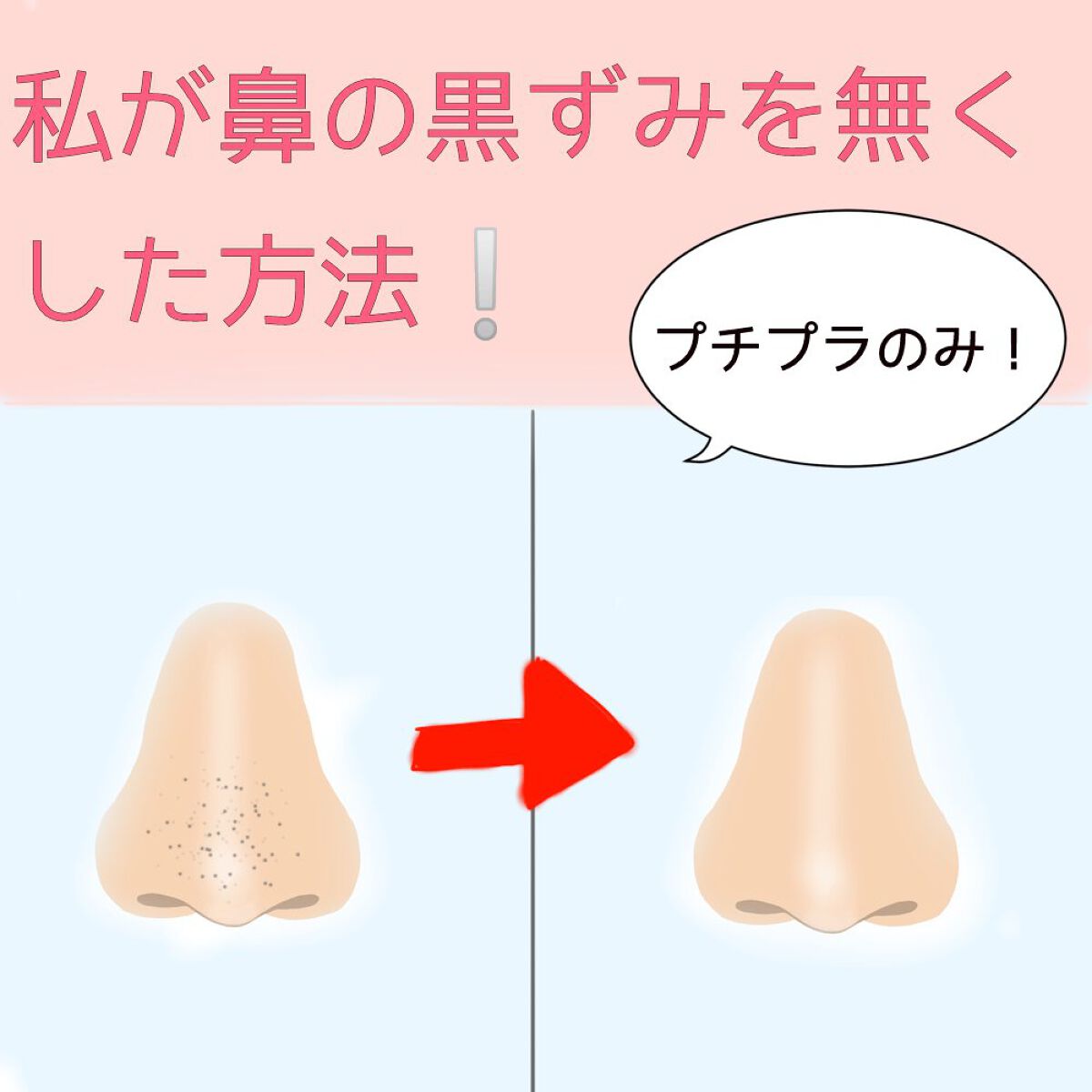 マイルド＆モイスチャーアロエジェル/ネイチャーリパブリック/ボディローションを使ったクチコミ（1枚目）