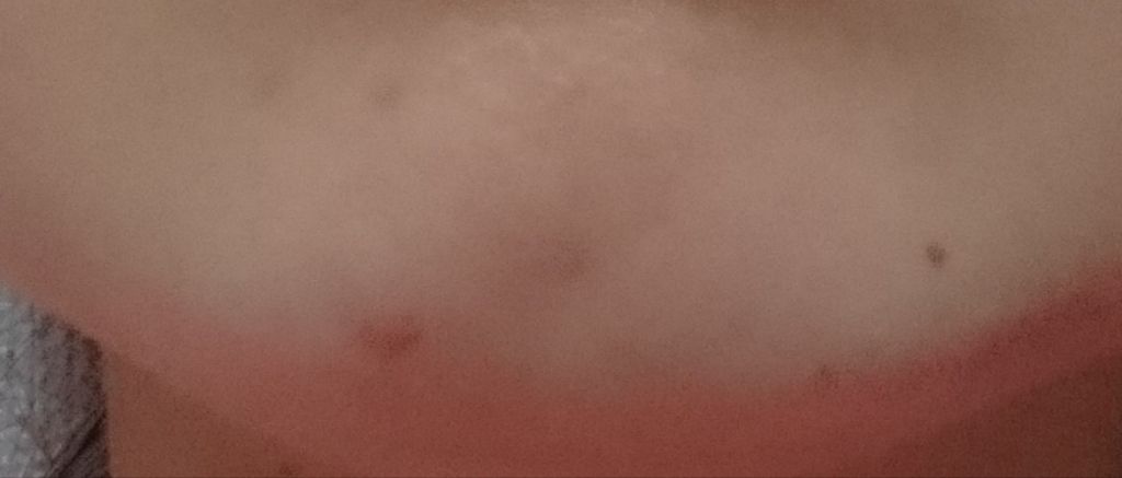 ポジティブソリューション/LUNASOL/美容液を使ったクチコミ（3枚目）