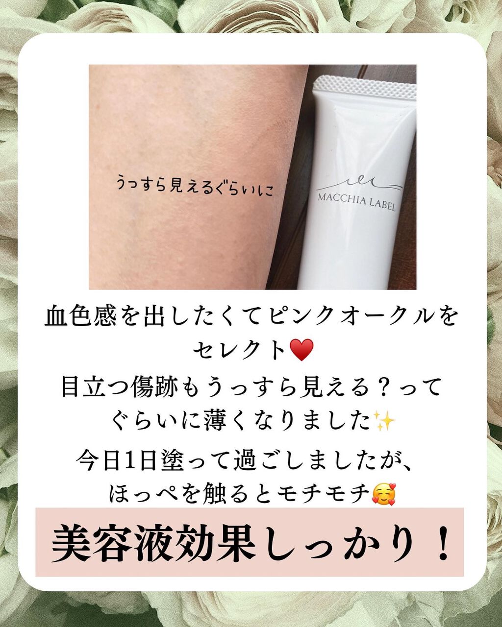 みぃ0912 on LIPS 「こんばんは🌙*゚みぃです🎀🔻𝕗𝕠𝕝𝕝𝕠𝕨𝕄𝕖🔻@miko_l..」(5枚目)