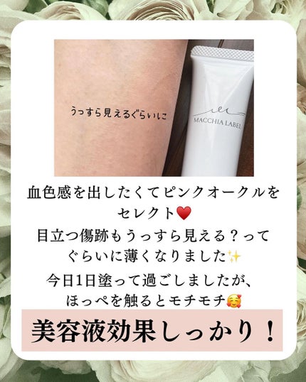 みぃ0912 on LIPS 「こんばんは🌙*゚みぃです🎀🔻𝕗𝕠𝕝𝕝𝕠𝕨𝕄𝕖🔻@miko_l..」(5枚目)