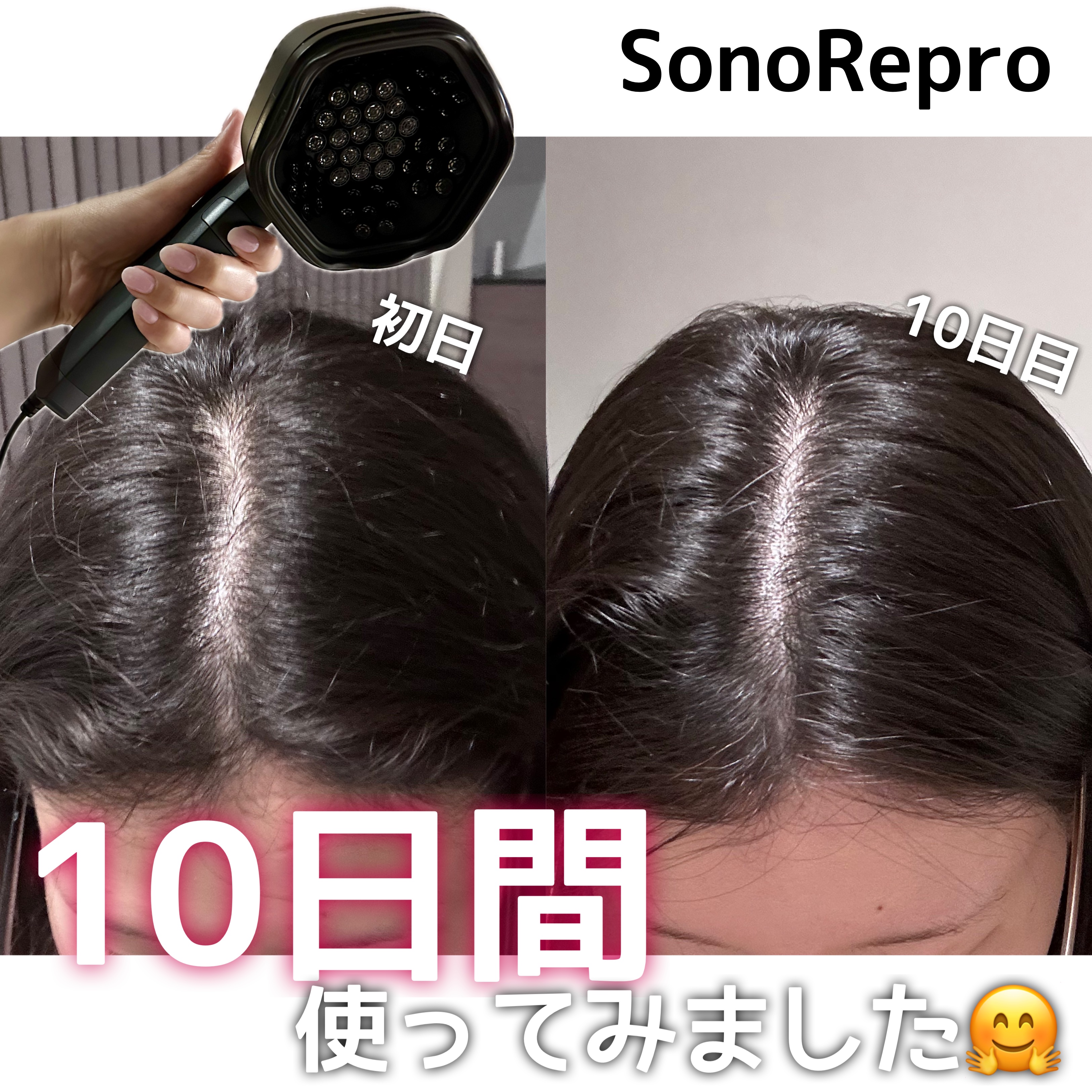 SonoRepro/アンファー(スカルプD)/ヘアケアグッズを使ったクチコミ（1枚目）
