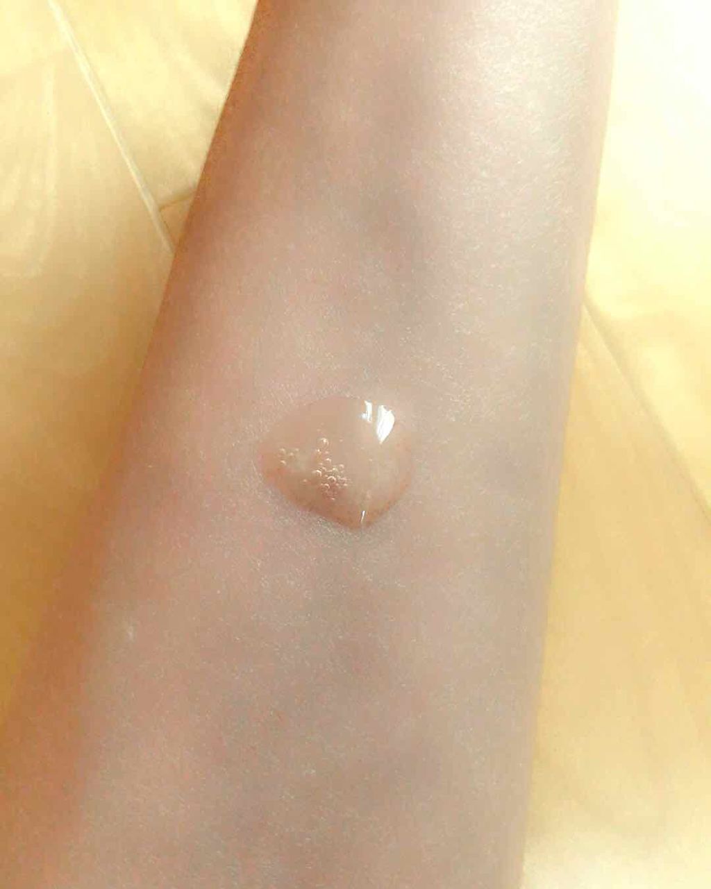 アクアインダーム導入エッセンス/ドクターシーラボⓇ/ブースター・導入液を使ったクチコミ（2枚目）