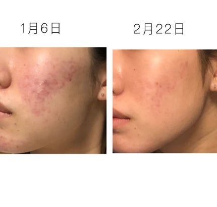 を使ったクチコミ(1枚目)