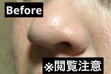 クリーンイットゼロ クレンジングバーム ポアクラリファイング/BANILA CO/クレンジングバームを使ったクチコミ(6枚目)