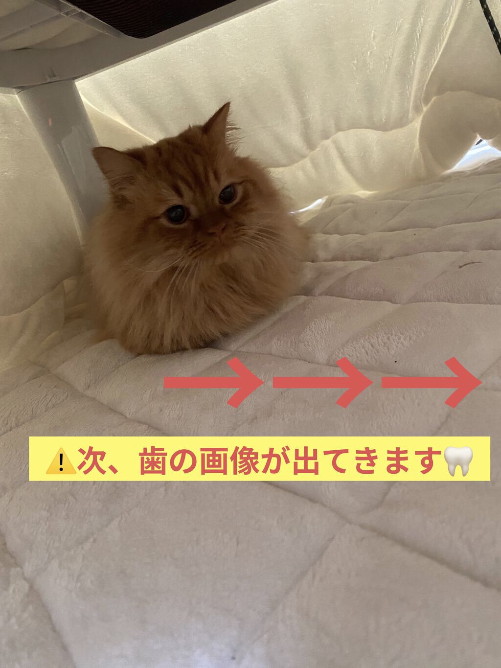 アパガードプレミオ/アパガード/歯磨き粉を使ったクチコミ（3枚目）