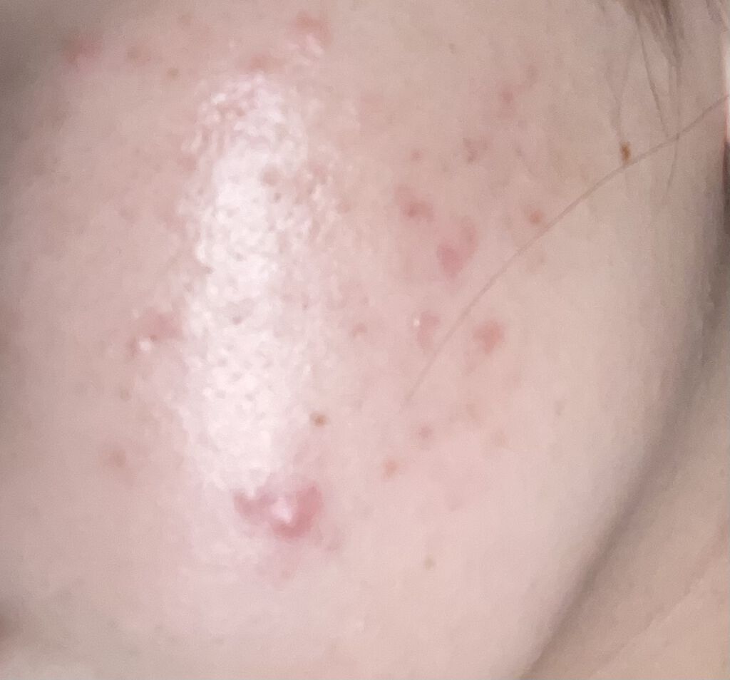 潤浸保湿 化粧水 III とてもしっとり/キュレル/化粧水を使ったクチコミ（1枚目）