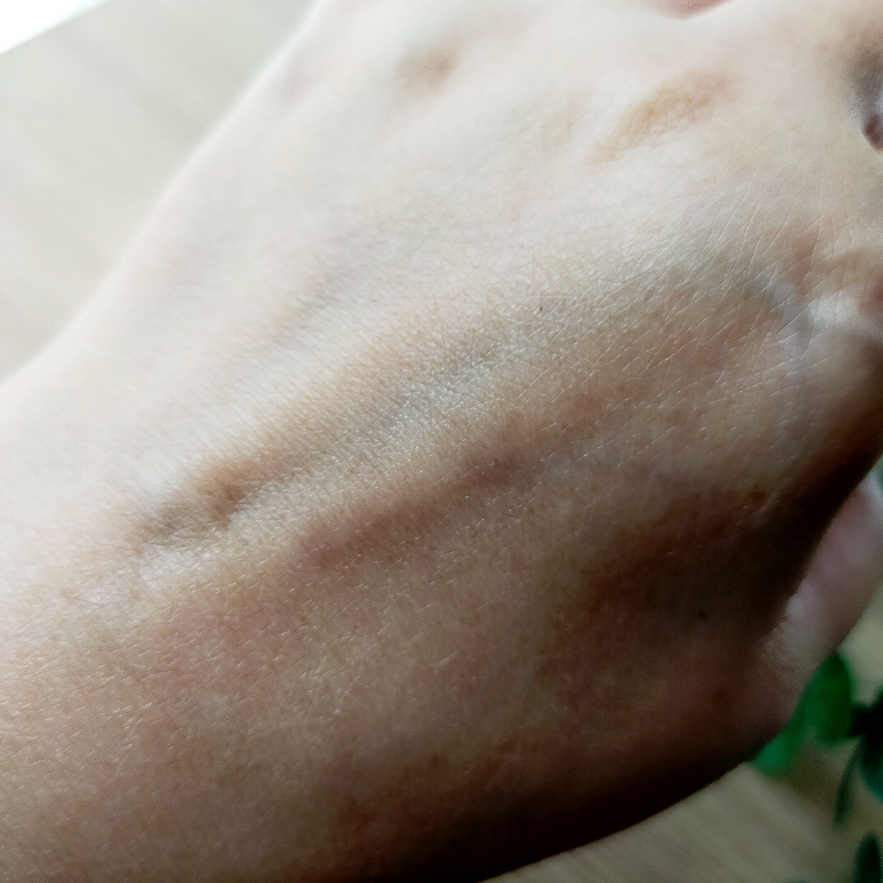 カロチーノジェル/セルキュレイト/フェイスクリームを使ったクチコミ（3枚目）