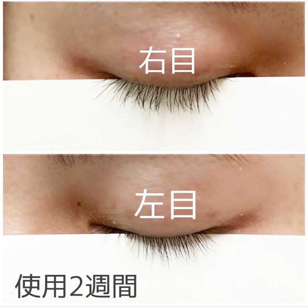 EMAKED(エマーキット)/水橋保寿堂製薬/まつげ美容液を使ったクチコミ(3枚目)