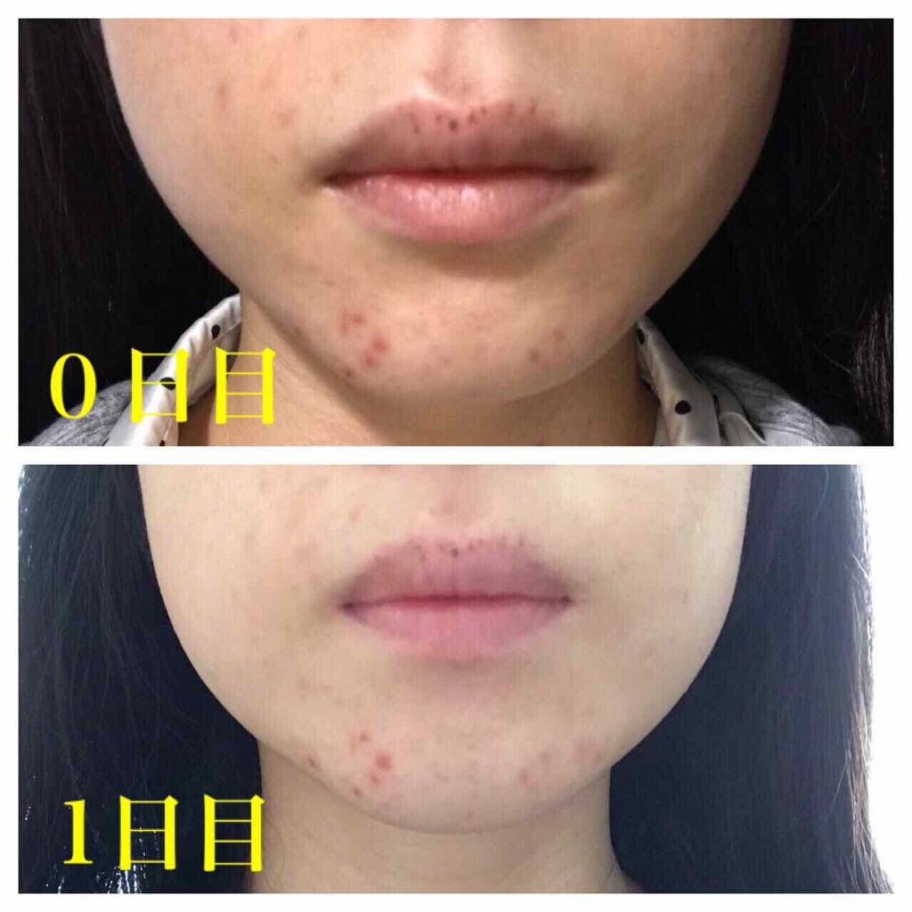 ファイバーフォーム/ルナメアAC/洗顔フォームを使ったクチコミ（3枚目）