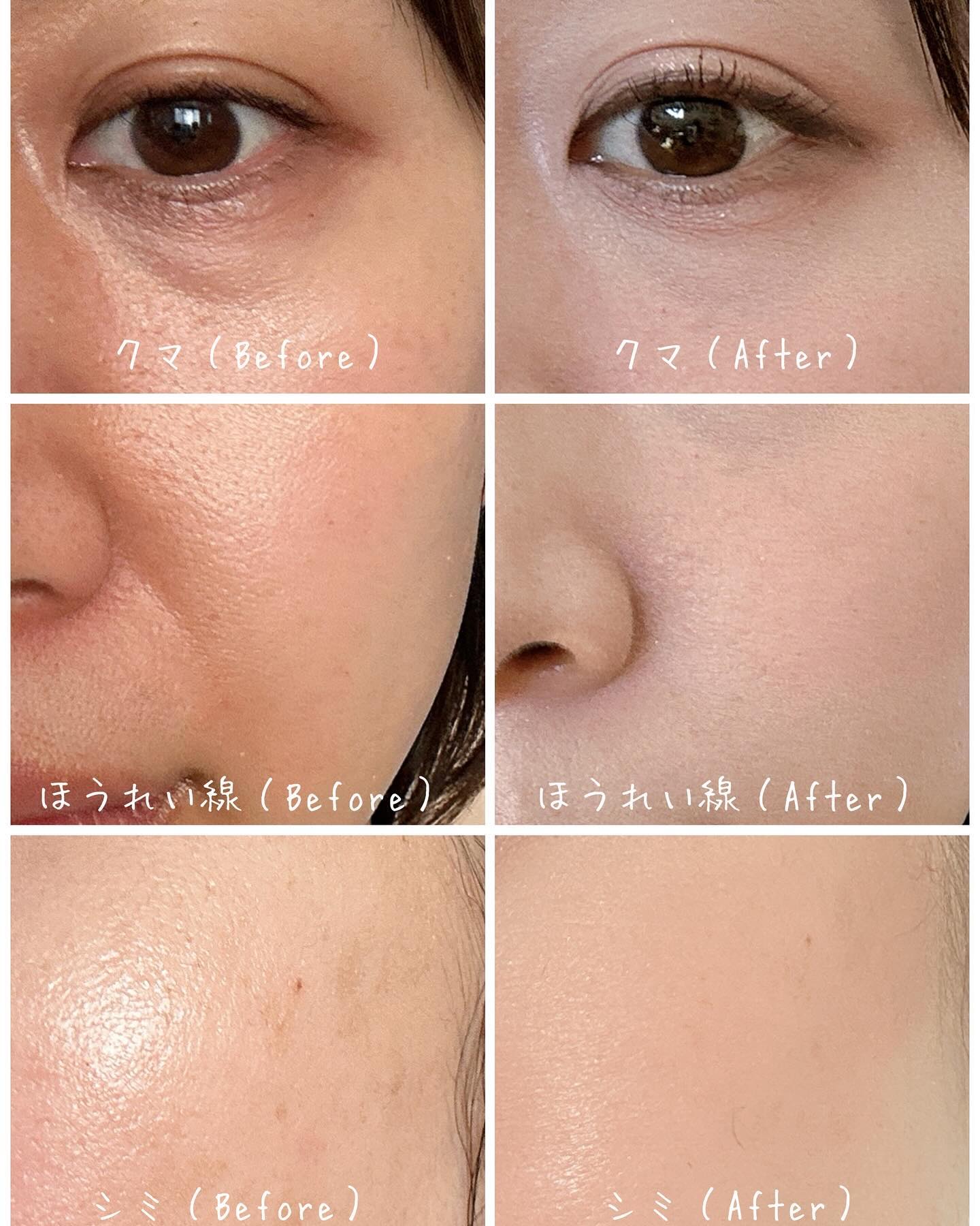 TIMAGE  クリーミーコンシーラーパレット/TIMAGE/パレットコンシーラーを使ったクチコミ（3枚目）