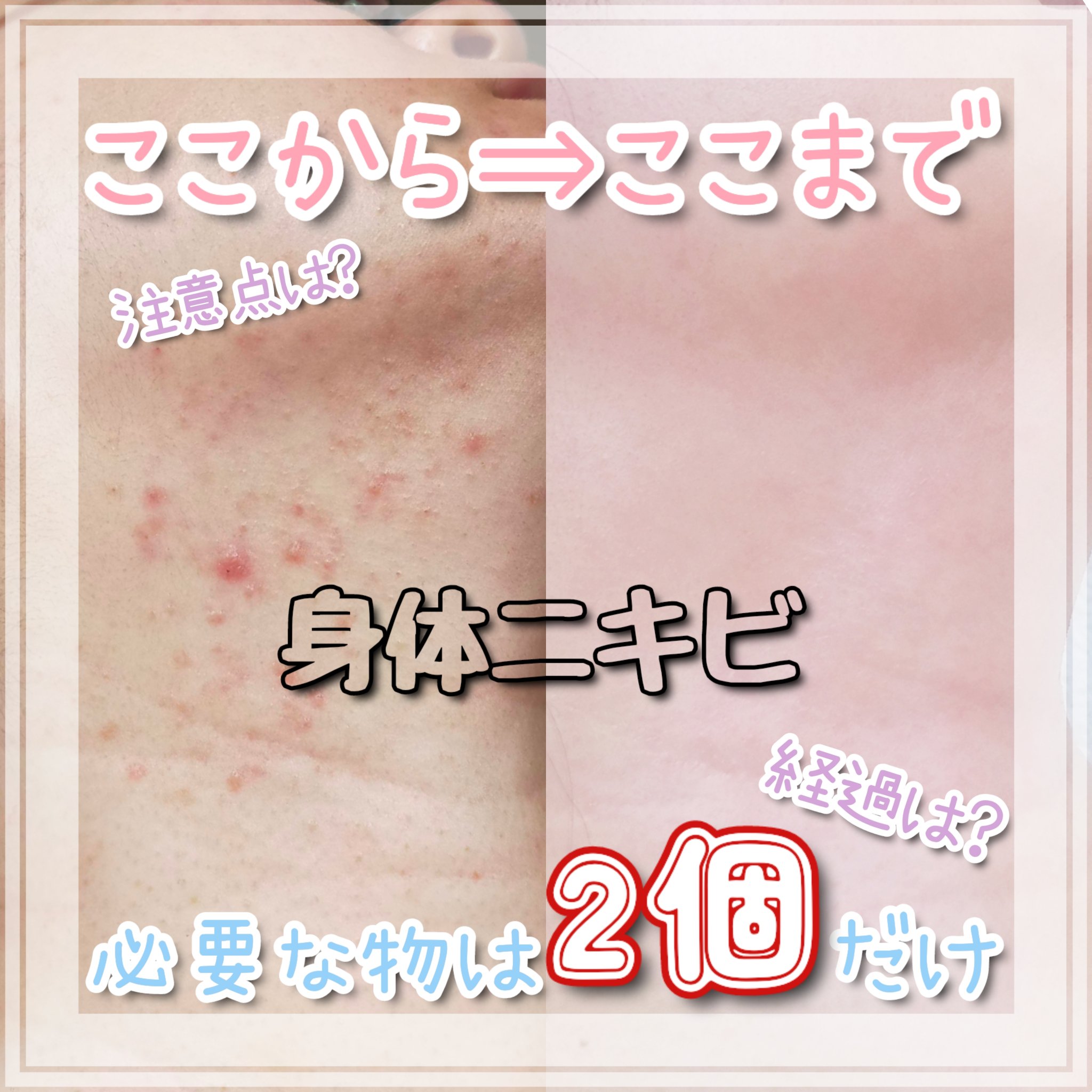 赤箱 (しっとり)/カウブランド/洗顔石鹸を使ったクチコミ（1枚目）