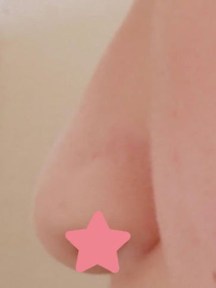 ノーズトレーナー/DAISO/その他スキンケアグッズを使ったクチコミ(4枚目)