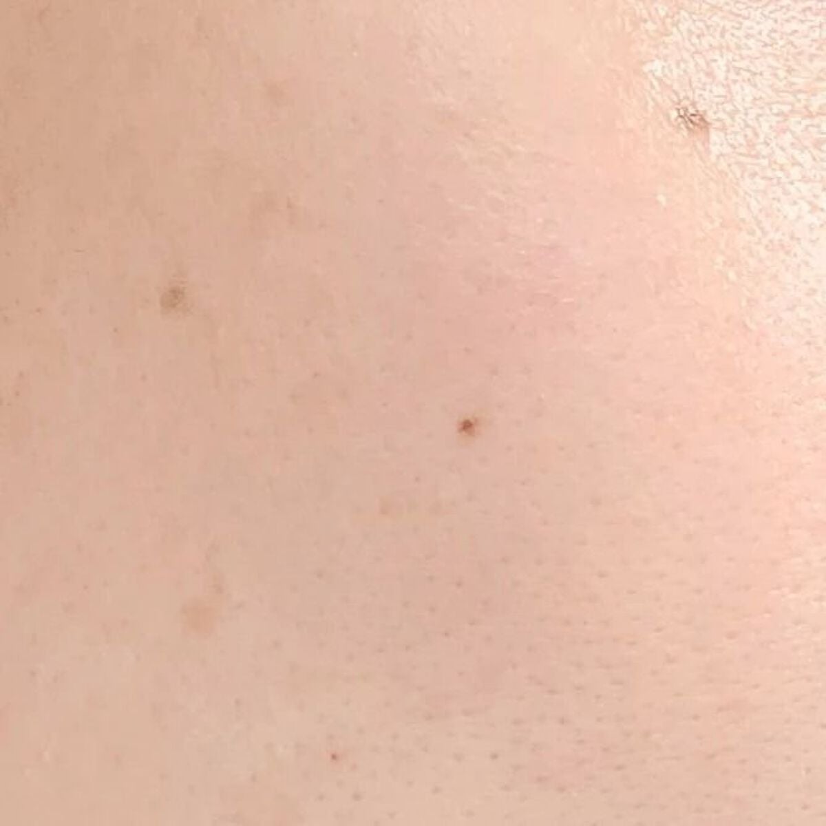 センテラ アンプル/SKIN1004/美容液を使ったクチコミ(5枚目)