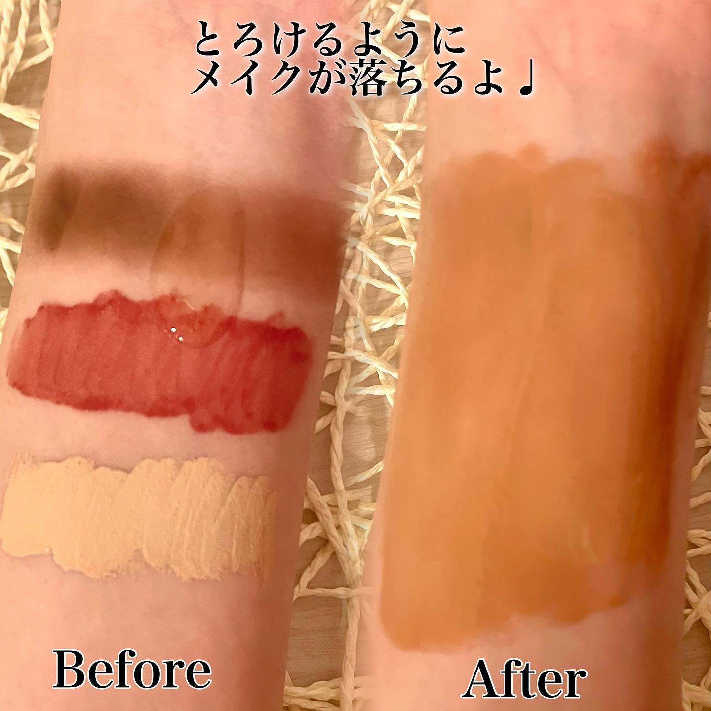 St-Care クレンジングオイルフォーム/orin/その他洗顔料を使ったクチコミ（2枚目）