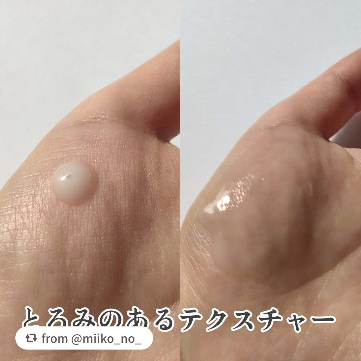 復活草ビフィダセラムファーミングドロップ/Abib /美容液を使ったクチコミ(3枚目)