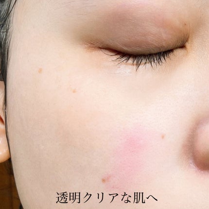 スパークロイドパック/MICHIKO.LIFE/洗い流すパック・マスクを使ったクチコミ(6枚目)