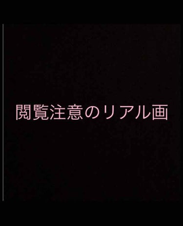 ピーリングジェル/DAISO/ピーリングを使ったクチコミ（2枚目）