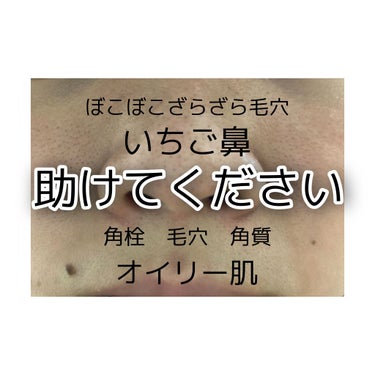 毛穴すっきりパック 鼻用 黒色タイプ/ビオレ/その他スキンケアを使ったクチコミ（1枚目）