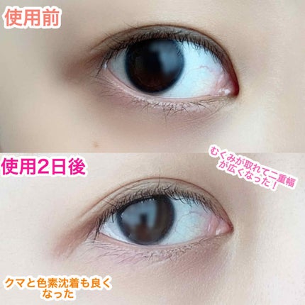 グラン アイ セラム/CLARINS/アイケア・アイクリームを使ったクチコミ(3枚目)