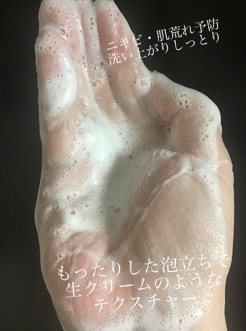 パーフェクトホイップ アクネケア/SENKA(専科)/洗顔フォームを使ったクチコミ(2枚目)