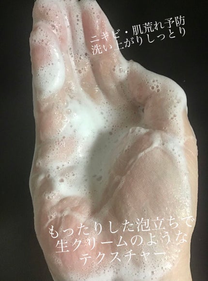 パーフェクトホイップ アクネケア/SENKA(専科)/洗顔フォームを使ったクチコミ(2枚目)