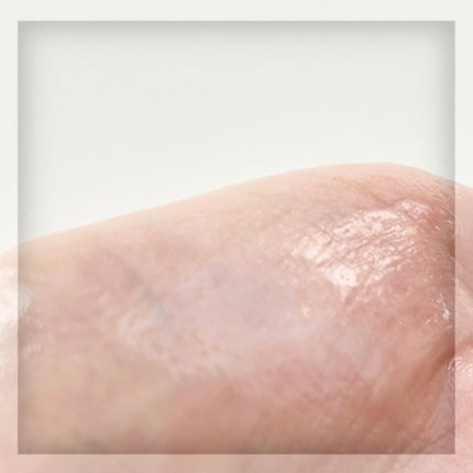 デイリーモイスチャーボディオイル/Derma:B/ボディオイルを使ったクチコミ(4枚目)