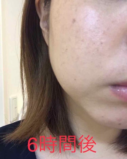 アルビオン スキングレイジング ファンデーション/ALBION/リキッドファンデーションを使ったクチコミ(4枚目)