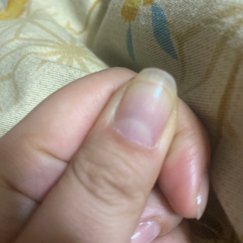 ウォータリーネイルジェル クイックグロス /D-UP/オールインワンネイルを使ったクチコミ(1枚目)