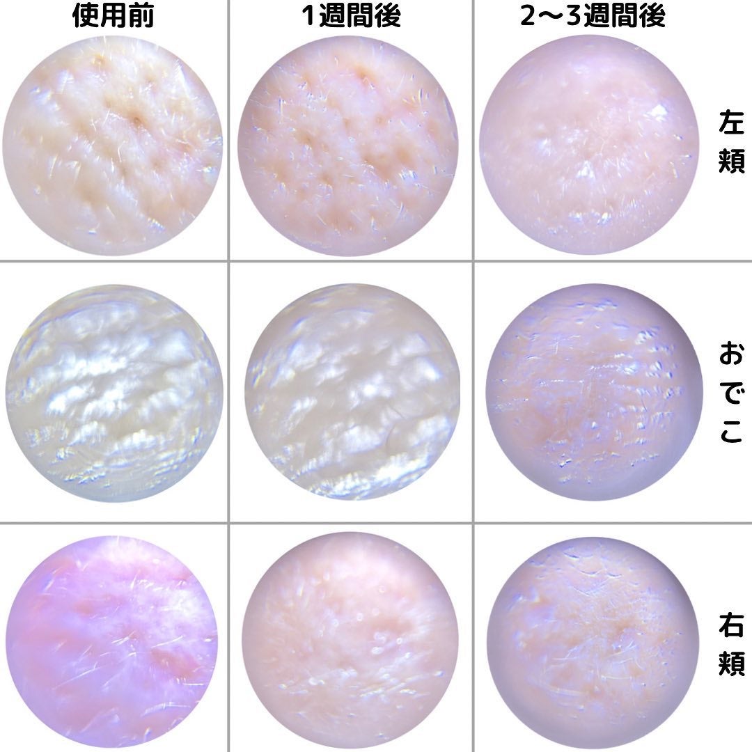 リードルショット100/VT/美容液を使ったクチコミ(9枚目)