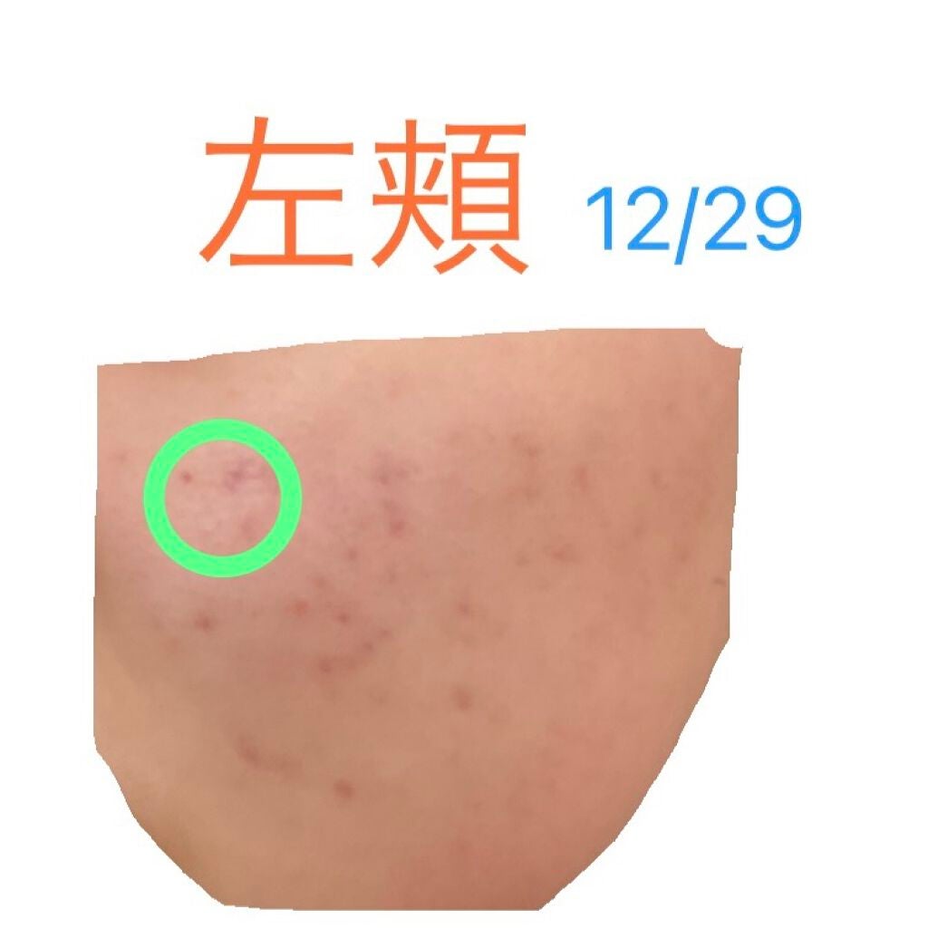 ハトムギ化粧水(ナチュリエ スキンコンディショナー R )/ナチュリエ/化粧水を使ったクチコミ(4枚目)