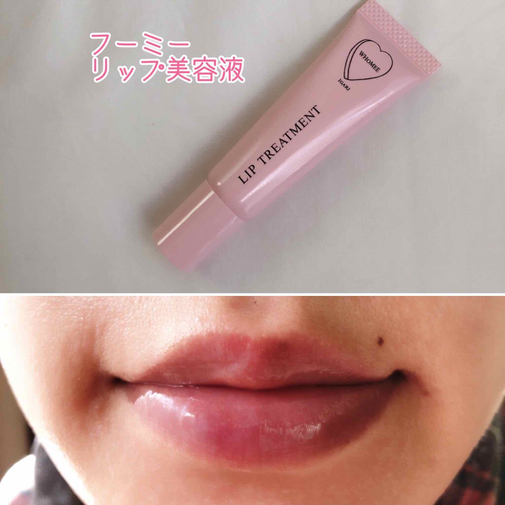 リップ美容液/WHOMEE/リップ美容液を使ったクチコミ（1枚目）