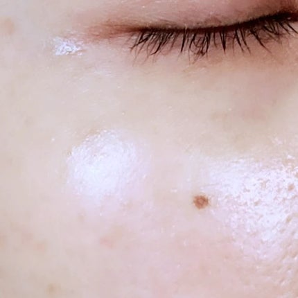 リンクルショット メディカル セラム N/リンクルショット/アイケア・アイクリームを使ったクチコミ(8枚目)