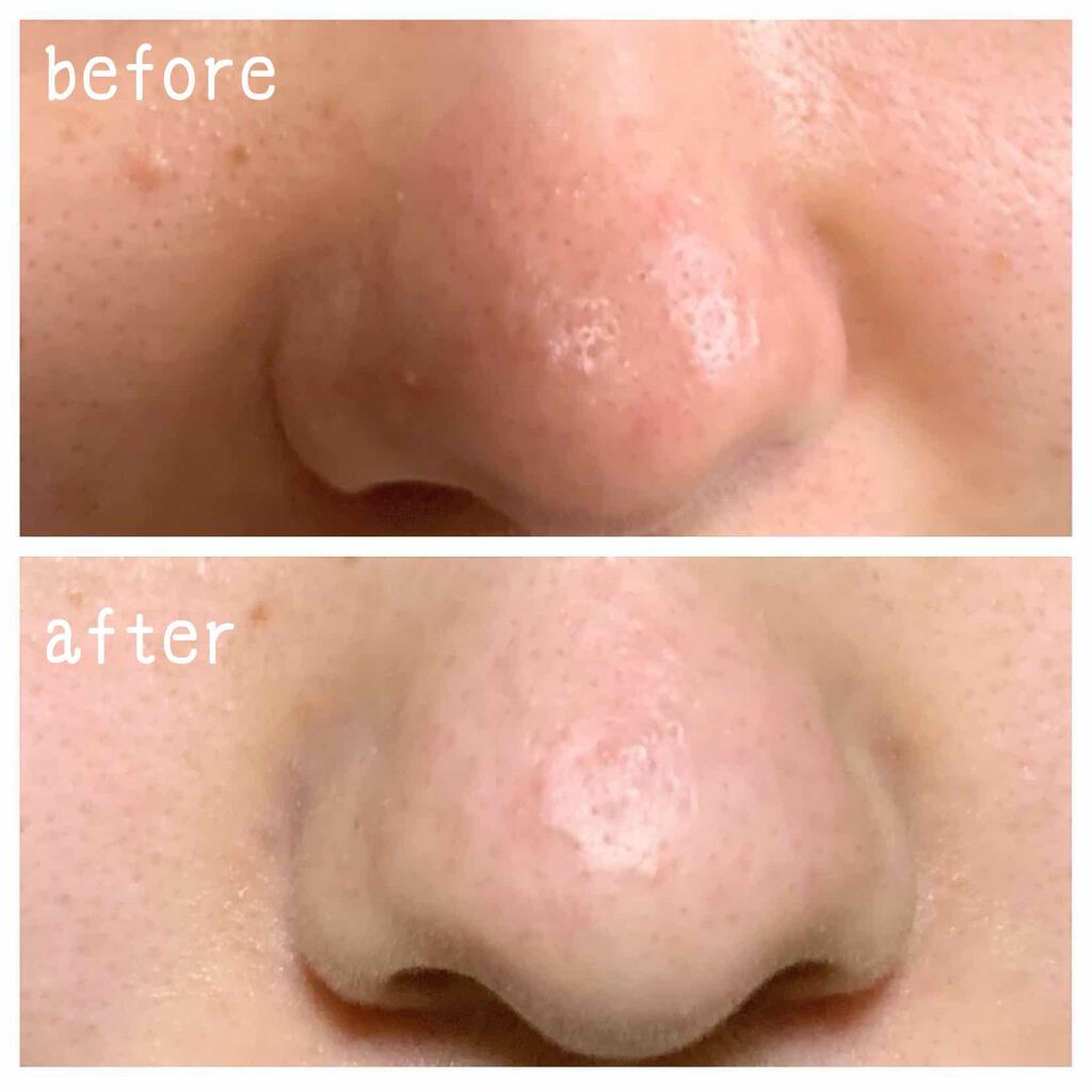 酵素洗顔パウダー/雪肌粋/洗顔パウダーを使ったクチコミ(2枚目)