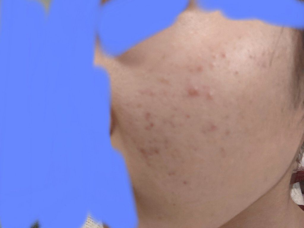 薬用ふわふわな泡洗顔/メンソレータム アクネス/泡洗顔を使ったクチコミ（2枚目）