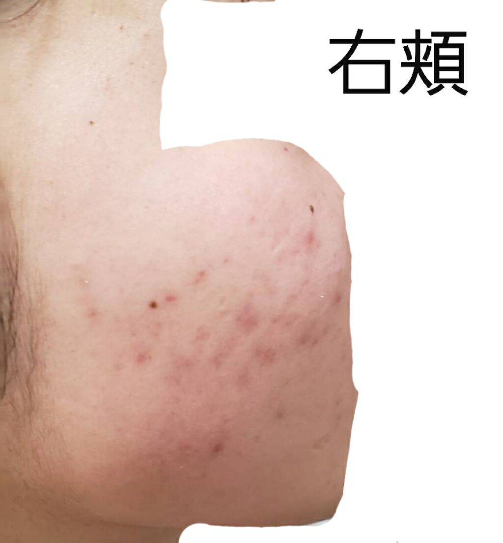 ハトムギ化粧水(ナチュリエ スキンコンディショナー R )/ナチュリエ/化粧水を使ったクチコミ(3枚目)