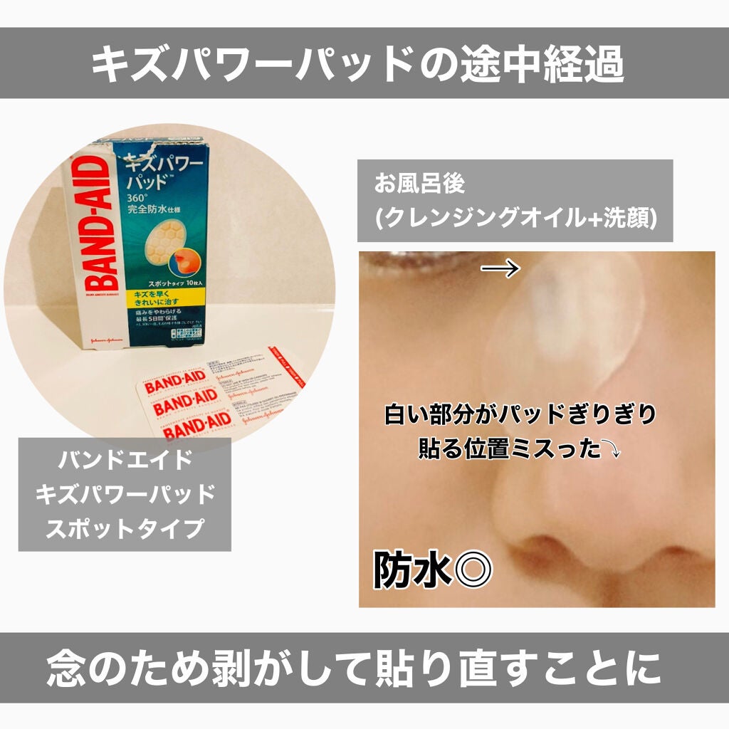 キズパワーパッド/バンドエイド/その他を使ったクチコミ(2枚目)