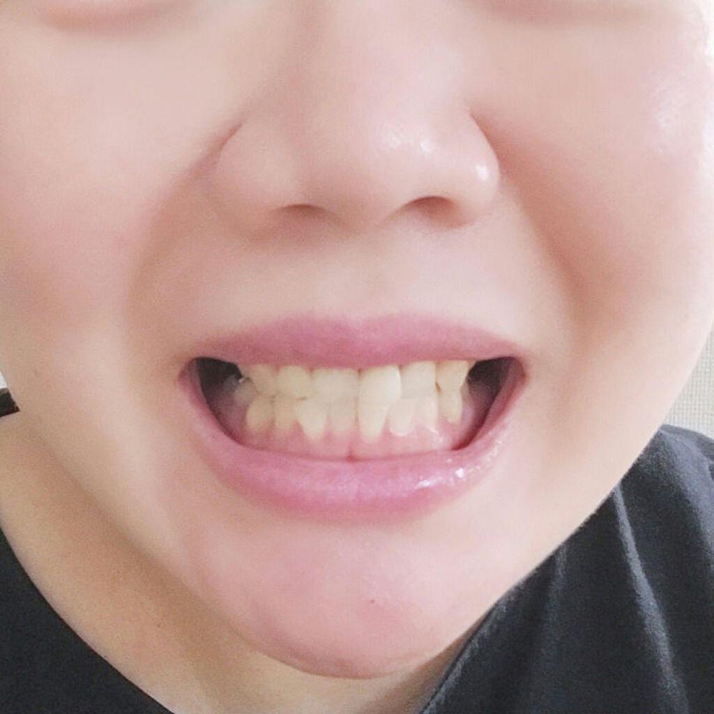 薬用歯磨き粉ペースト/MOTETAMA(モテたま)/歯磨き粉を使ったクチコミ(4枚目)