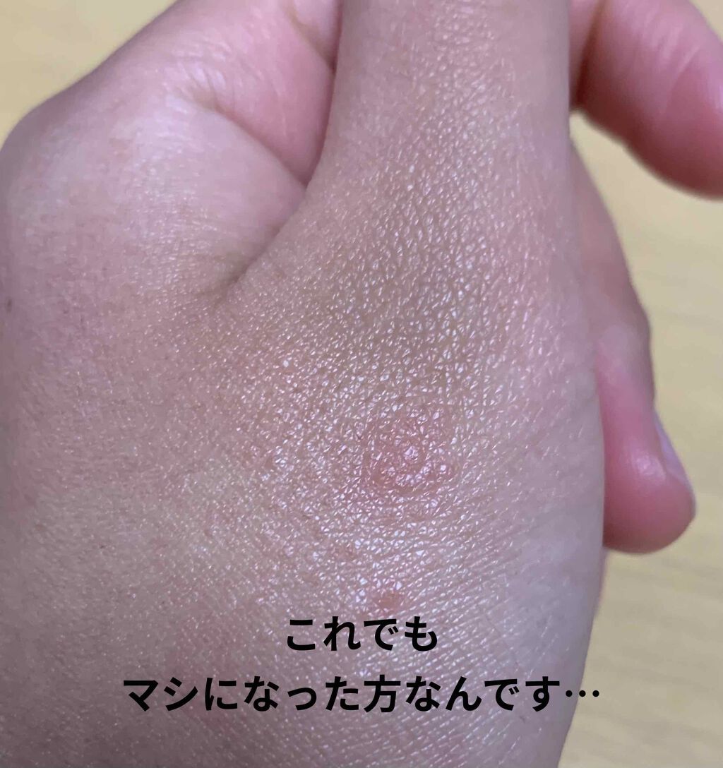 白色ワセリン(医薬品)/健栄製薬/その他を使ったクチコミ（2枚目）