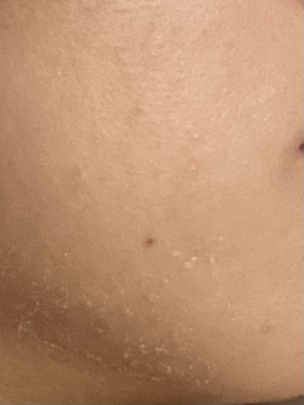 レチノールインテンスリアクティベーションマスク/SOME BY MI/シートマスク・パックを使ったクチコミ（2枚目）