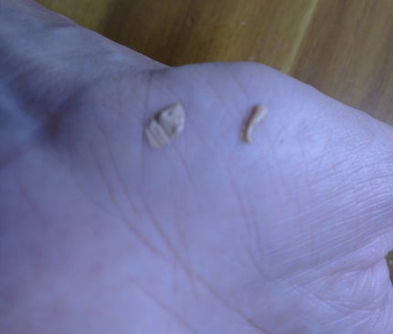 びー玉 on LIPS 「⭐顔の傷跡を隠すコンシーラーのおすすめ⭐そして肌に優しいもの🐇..」(4枚目)