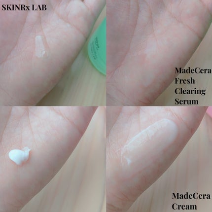 マデセラクリーム/SKINRx LAB/フェイスクリームを使ったクチコミ(4枚目)