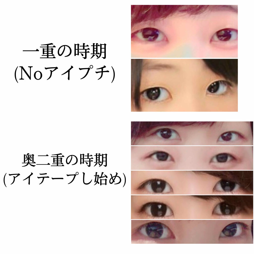 メッシュ アイテープ/shefun/二重まぶた用アイテムを使ったクチコミ（2枚目）