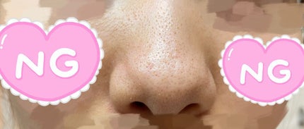 ツルリ 皮脂吸い出し 部分用パック ガスール&レッドパワー/ツルリ/洗い流すパック・マスクを使ったクチコミ(2枚目)