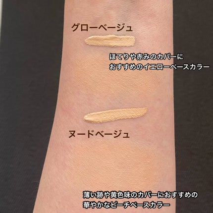 ダーマシンコンシーラー/23years old/リキッドコンシーラーを使ったクチコミ(6枚目)