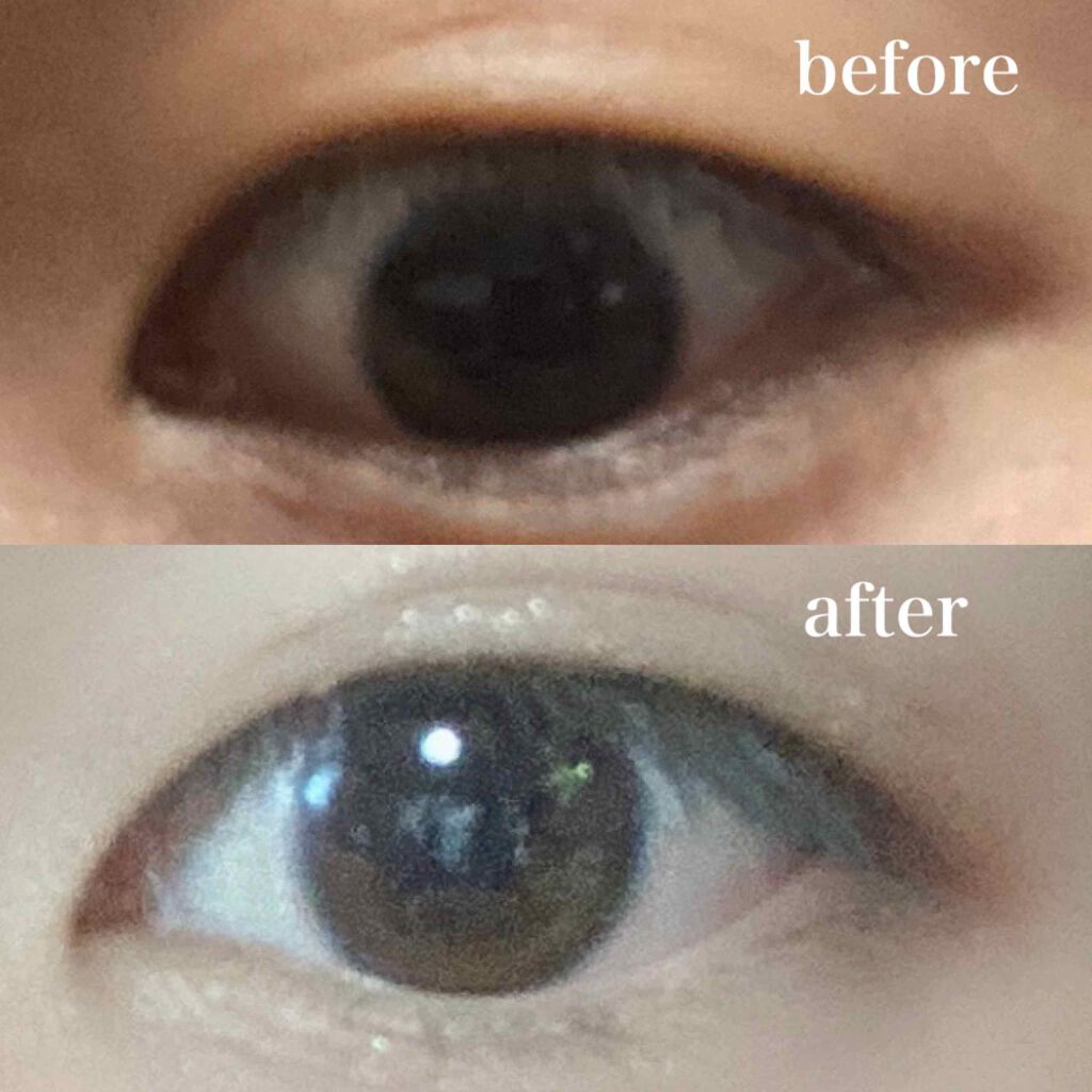 のびーるアイテープ(絆創膏タイプ、レギュラー)/DAISO/二重まぶた用アイテムを使ったクチコミ(1枚目)