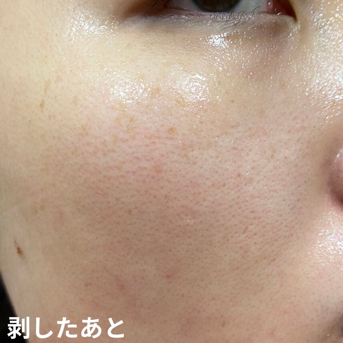 ダイヤモンドモイスチャー アクアモイスチャー シートマスク/ALFACE+/シートマスク・パックを使ったクチコミ(7枚目)