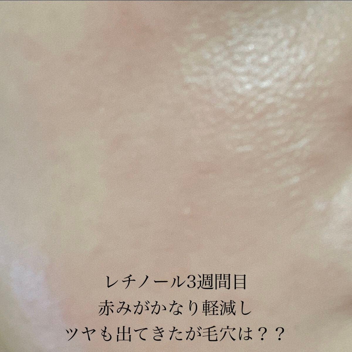 RXザ・レチノール0.1クリーム/COSRX/フェイスクリームを使ったクチコミ(6枚目)